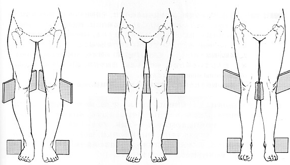 図解姿勢検査法